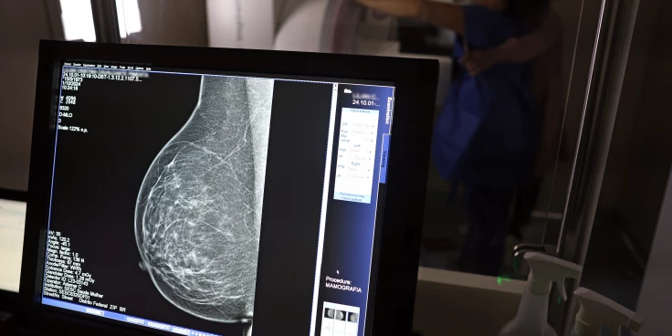 Plano de saúde terá que cobrir mamografia digital para todas as idades